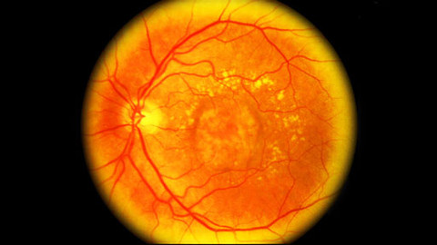 PORT - 2. prosince 2009