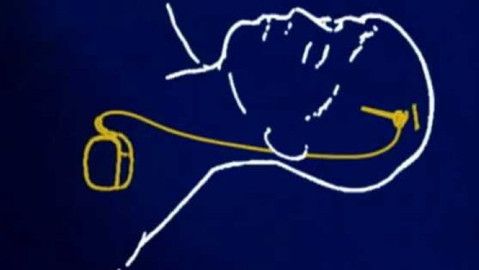 Diagnóza - Parkinsonova choroba