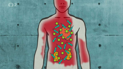 Dobrodružství vědy a techniky - Boj se sepsí - nový výzkum přináší naději