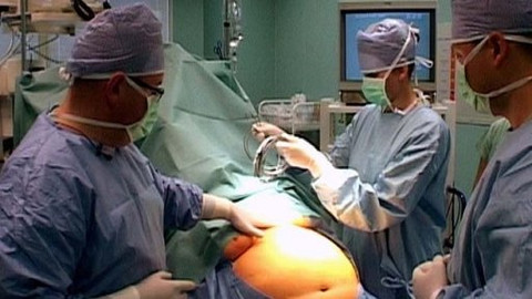 Diagnóza - Léčba obezity