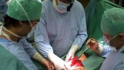 Diagnóza - Náhrada konečníku tenkým střevem