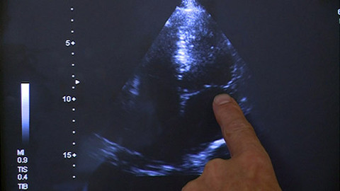 Medicína pro 21. století - Fabryho choroba