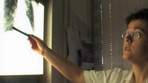 Diagnóza - Karcinom plic