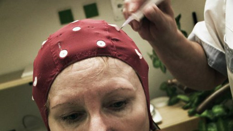 Diagnóza - Opar na mozku