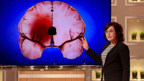 DoktorKA - Hrozí Vám riziko mrtvice?