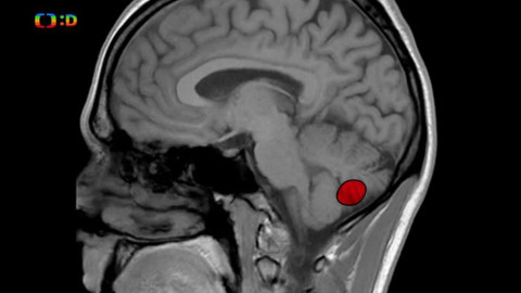 Operace JAUU! - Epizoda 37/69