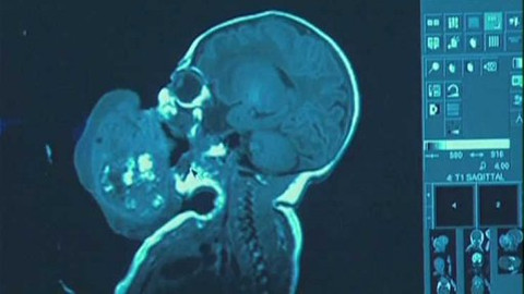 Věda a náhoda - 2/6 Podivuhodné obrazy