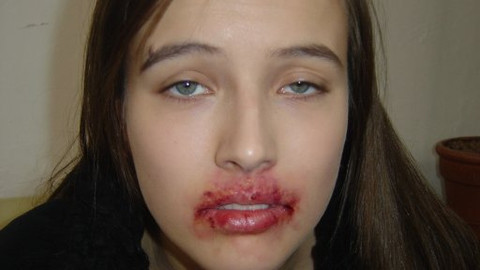 Černá sanitka - 12/15 Flirt s cizincem