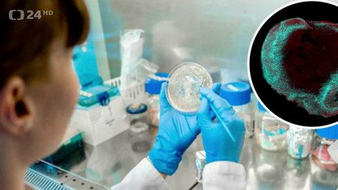 Regiony ČT24 - 18. listopadu 2023