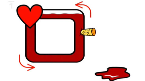 Dětská záchranka v akci - Silné krvácení