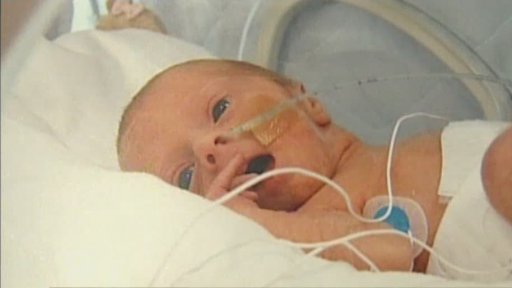 Transfúze krevních destiček