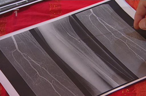 Hrozby při diabetes