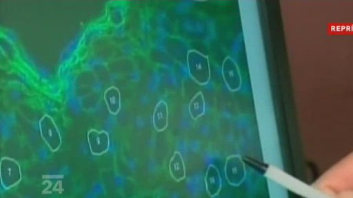 Cukrová vata v medicíně