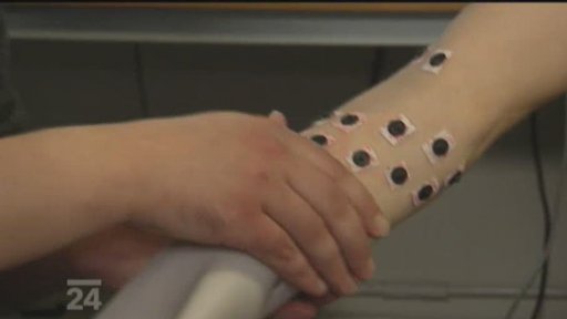 Umělá náhražka horních končetin