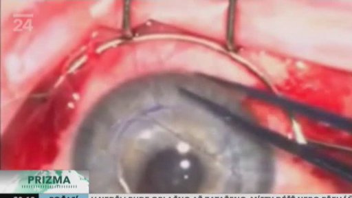 Jak porazit slepotu?