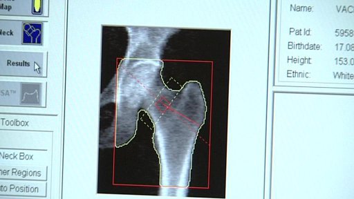 Kostní ambulanci v Klatovech omezují zdravotní pojišťovny