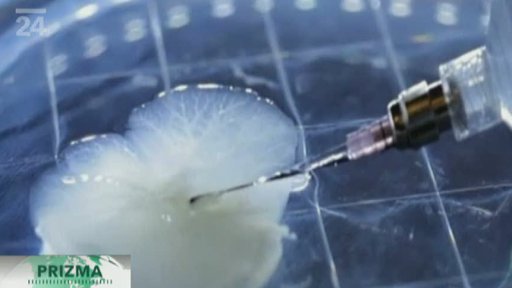 Výroba umělých orgánů