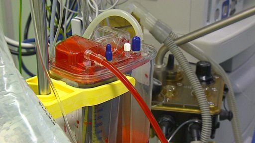 Novinka v jihlavské nemocnici - přístroj na čištění krve