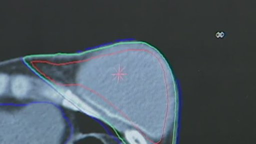 Vadné implantáty děsí ženy