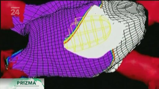 USA: hydrogel opraví srdce