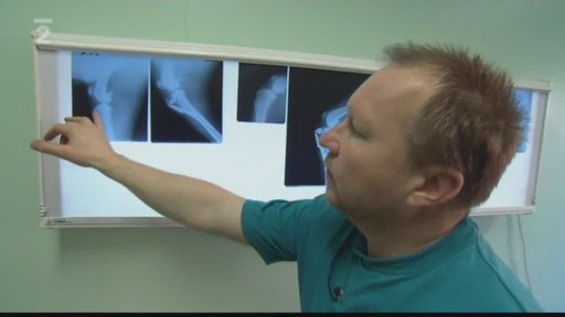 Kolena, ó kolena…