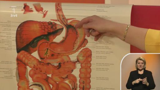 Onemocnění a moderní vyšetření žaludku - MUDr. Anna Jungwirthová (dotazy)  - 1.část