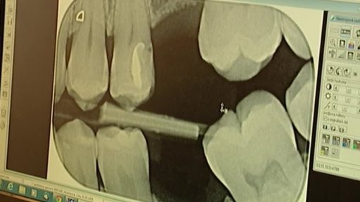 Podezřelé výkony zubních lékařů