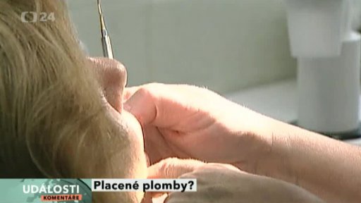 Placené plomby?