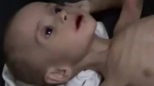 Sýrie: hlad jako nástroj války