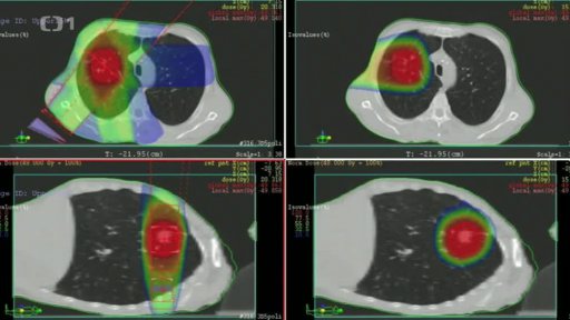 Protonové centrum na léčbu rakoviny bez pacientů