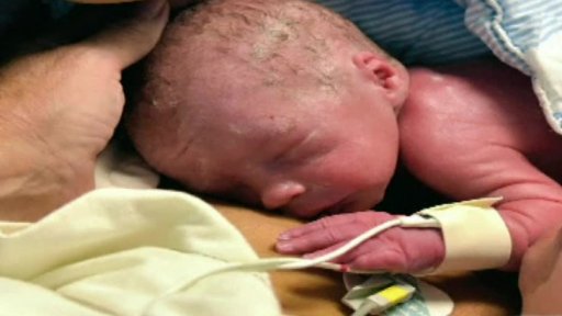 Transplantace dělohy