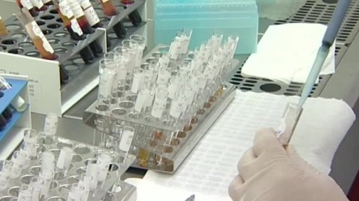 Klíč k diagnóze Alzheimerovy nemoci