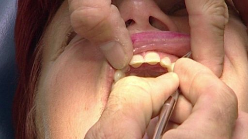 V Semilech chybějí zubaři, ruská lékařka s pětiletou praxí ale nastoupit nemůže