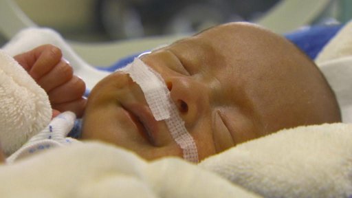 V ČR přibývá předčasně narozených dětí