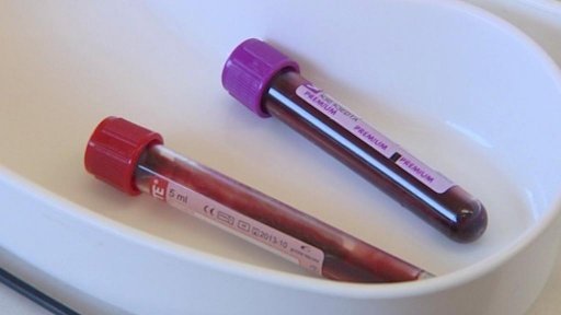 Nemocnice bojují s dluhy za testy na alkohol