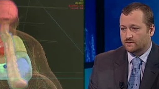 Čekání na léčbu protonem