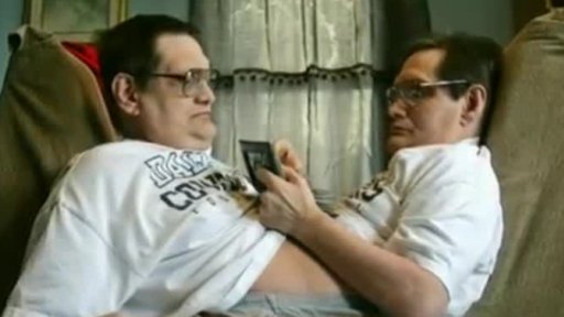 Siamská dvojčata se blíží k rekordu