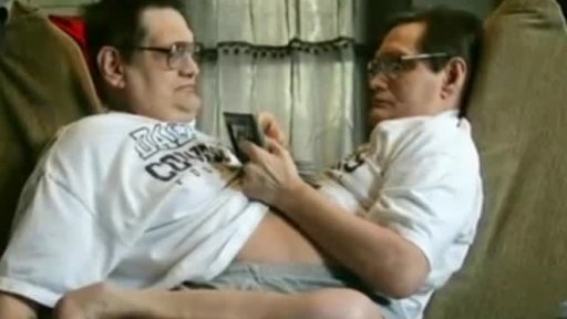 Siamská dvojčata se blíží k rekordu