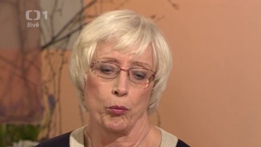 Absces - Prof. MUDr. Jaroslava Dušková, CSc. (dotazy) - 2. část