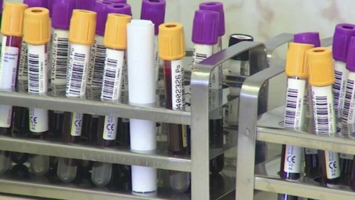 Žloutenka na severu Čech