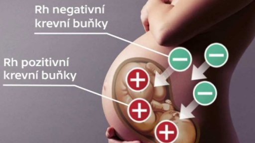 Australanova krev pomohla milionům dětí