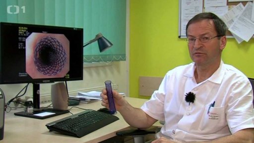 Stenty z Hradce Králové