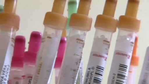 Epidemie žloutenky typu A