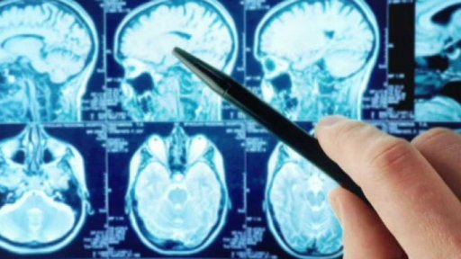 Doplatky léků pro lidi s Parkinsonovou chorobou