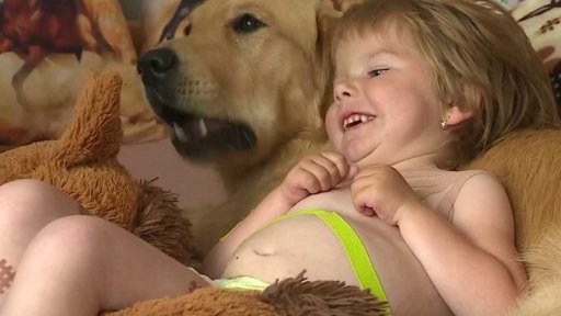 Léčba svalové atrofie