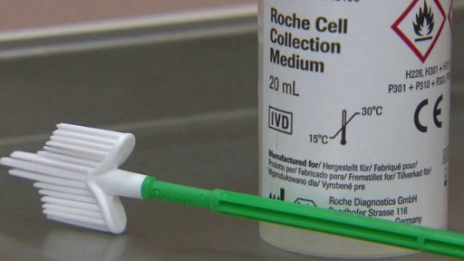 Diagnostika přednádorových změn