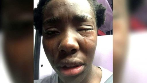 Itálie: napadení černošské atletky