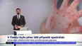 V Česku bylo přes 100 případů spalniček