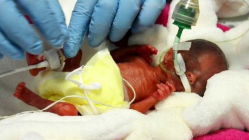 Lékaři zachránili jedno z nejmenších dětí