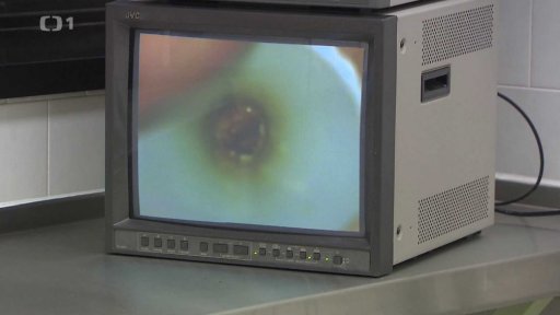 Jak hluk poškozuje sluchový aparát